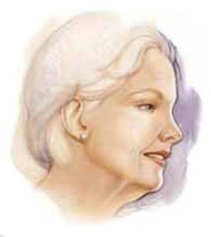 http://www.surgery.org/sites/default/files/facelift-before.jpg