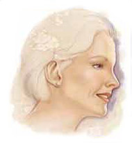 http://www.surgery.org/sites/default/files/facelift-after.jpg