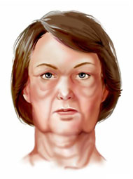 http://www.surgery.org/sites/default/files/face_neck_lift_1.jpg