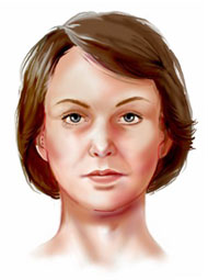 http://www.surgery.org/sites/default/files/face_neck_lift_2.jpg